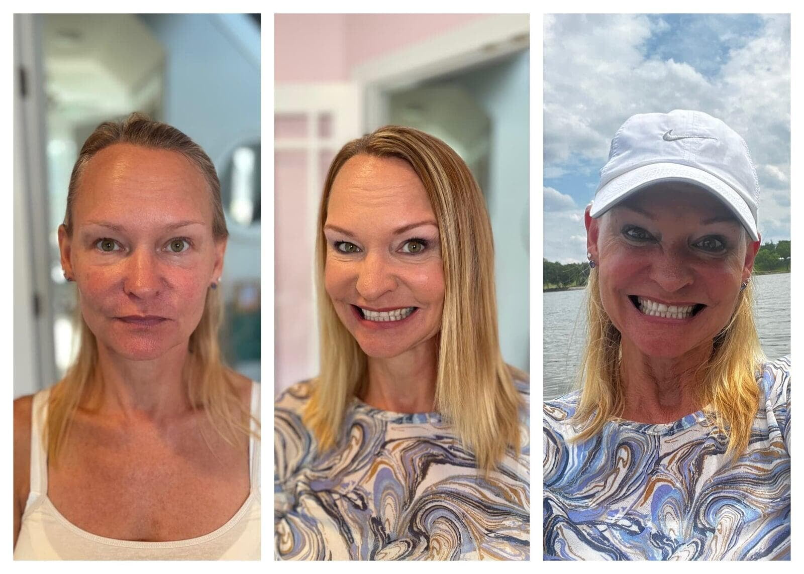 Before And After Beauty Reinvented